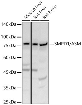 ASM Antibody in Western Blot (WB)