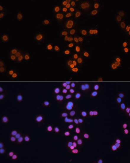 CDX2 Antibody in Immunocytochemistry (ICC/IF)