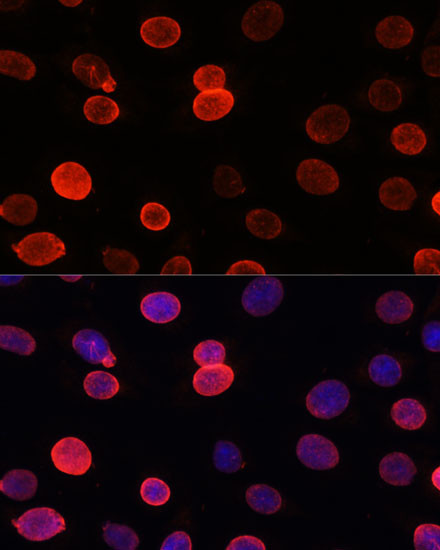 UNC84B Antibody in Immunocytochemistry (ICC/IF)