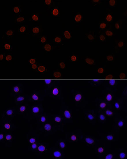 UNC84B Antibody in Immunocytochemistry (ICC/IF)