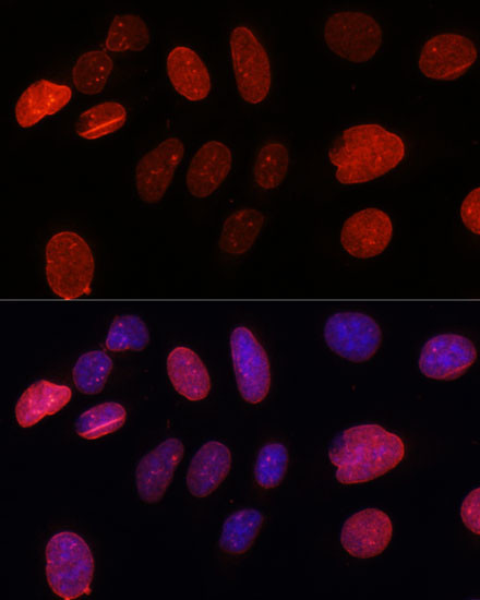 UNC84B Antibody in Immunocytochemistry (ICC/IF)