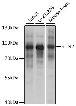 UNC84B Antibody in Western Blot (WB)