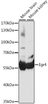 EGR4 Antibody in Western Blot (WB)