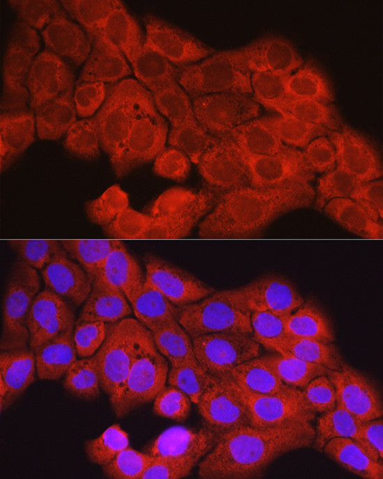 SCD Antibody in Immunocytochemistry (ICC/IF)