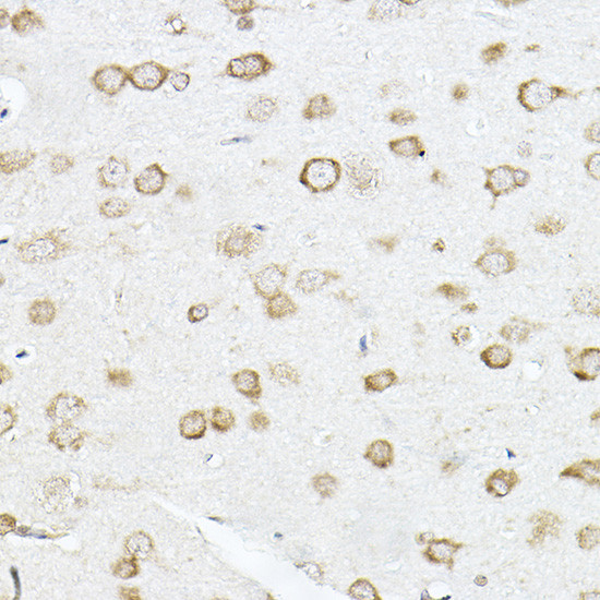 SCD Antibody in Immunohistochemistry (Paraffin) (IHC (P))