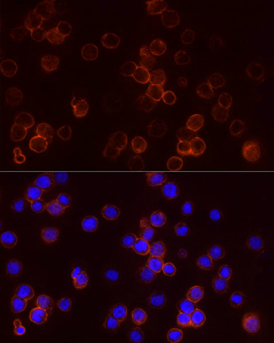 STAR Antibody in Immunocytochemistry (ICC/IF)