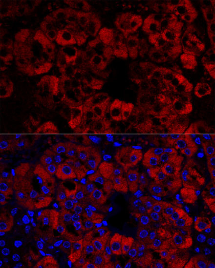 STAR Antibody in Immunohistochemistry (Paraffin) (IHC (P))