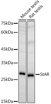 STAR Antibody in Western Blot (WB)