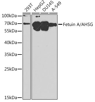 Fetuin A Antibody in Western Blot (WB)