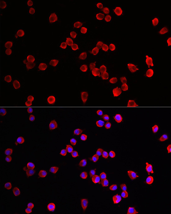 HRH3 Antibody in Immunocytochemistry (ICC/IF)