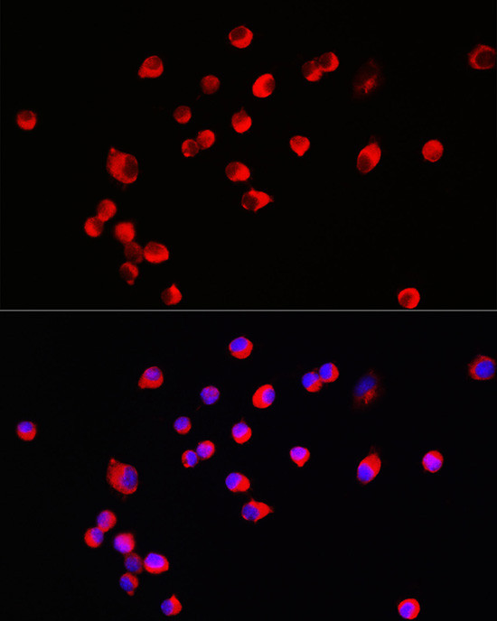 HRH3 Antibody in Immunocytochemistry (ICC/IF)