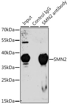 SMN Antibody in Immunoprecipitation (IP)