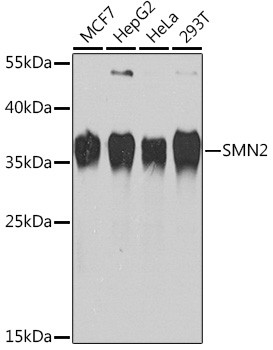 SMN Antibody in Western Blot (WB)