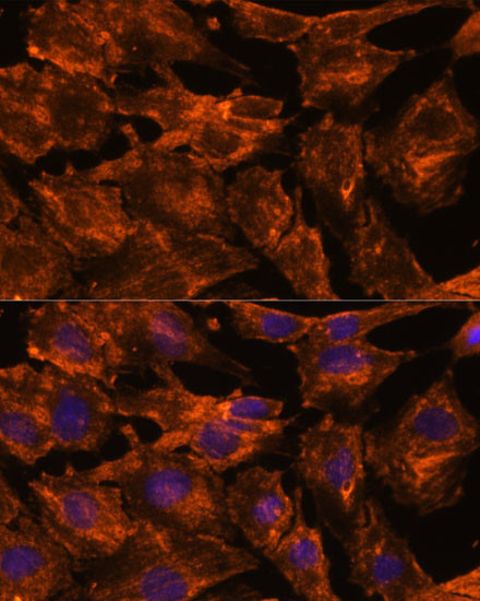 ITSN2 Antibody in Immunocytochemistry (ICC/IF)