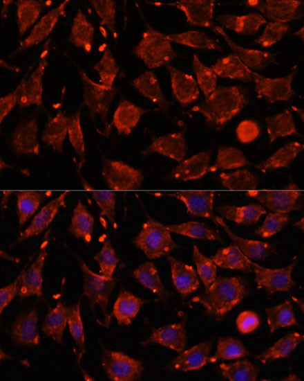 ITSN2 Antibody in Immunocytochemistry (ICC/IF)