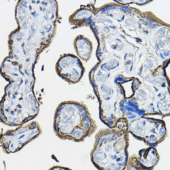 CD46 Antibody in Immunohistochemistry (Paraffin) (IHC (P))