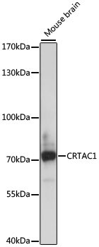 CRTAC1 Antibody in Western Blot (WB)