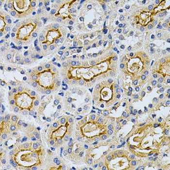 GRK2 Antibody in Immunohistochemistry (Paraffin) (IHC (P))