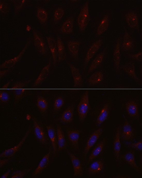 PCM1 Antibody in Immunocytochemistry (ICC/IF)