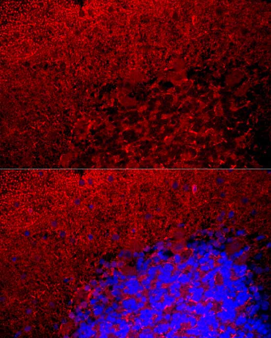 MBP Antibody in Immunocytochemistry (ICC/IF)