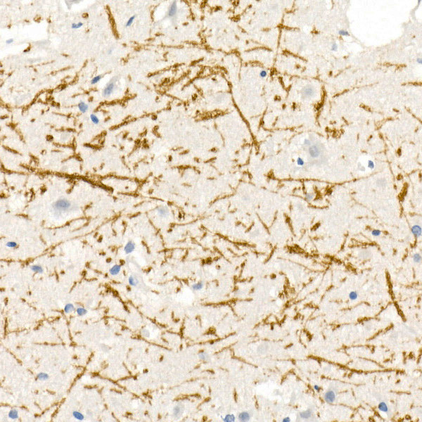 MBP Antibody in Immunohistochemistry (Paraffin) (IHC (P))