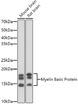 MBP Antibody in Western Blot (WB)