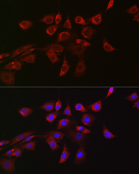 DNM1L Antibody in Immunocytochemistry (ICC/IF)