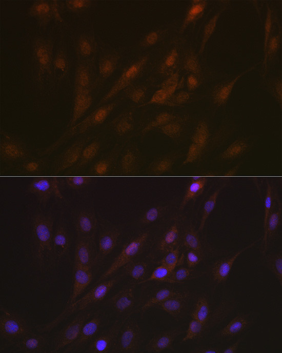 PYCARD Antibody in Immunocytochemistry (ICC/IF)