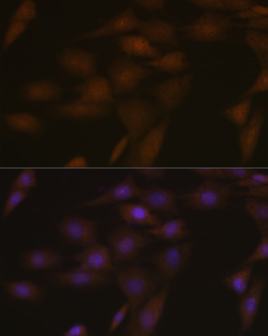 PYCARD Antibody in Immunocytochemistry (ICC/IF)