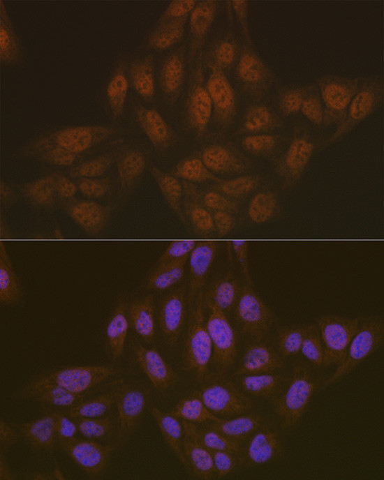 PYCARD Antibody in Immunocytochemistry (ICC/IF)