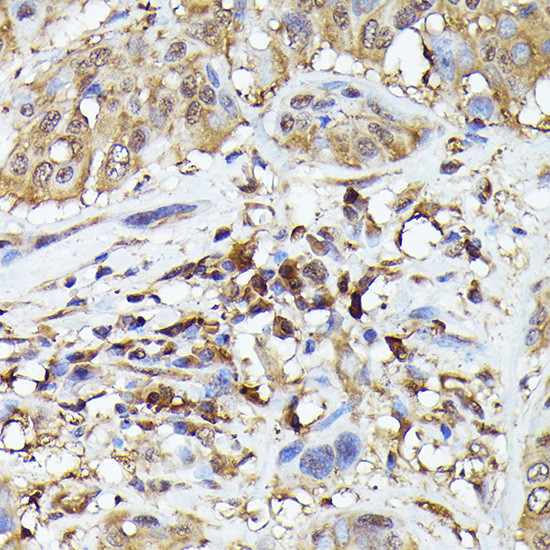 PYCARD Antibody in Immunohistochemistry (Paraffin) (IHC (P))