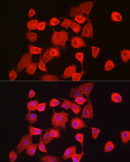 NOTCH1 Antibody in Immunocytochemistry (ICC/IF)