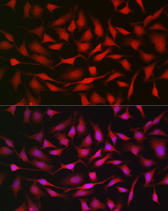 NOTCH1 Antibody in Immunocytochemistry (ICC/IF)