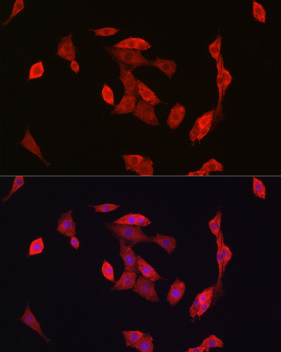 NOTCH1 Antibody in Immunocytochemistry (ICC/IF)