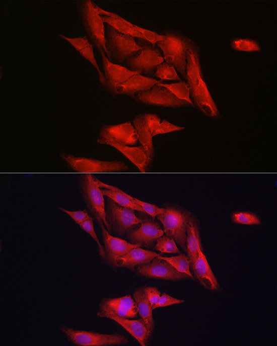 NOTCH1 Antibody in Immunocytochemistry (ICC/IF)