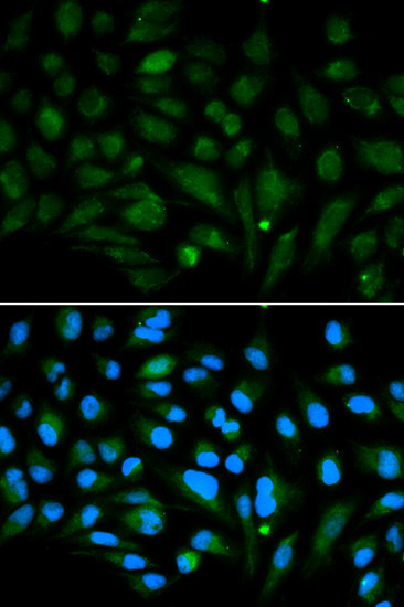 Decorin Antibody in Immunocytochemistry (ICC/IF)