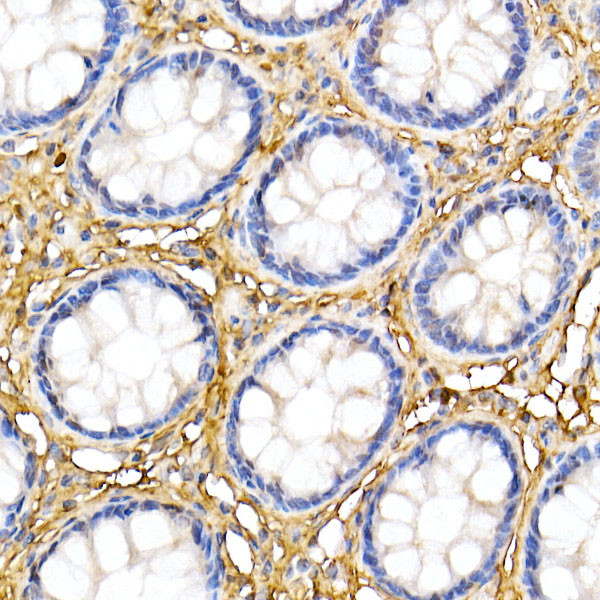 Decorin Antibody in Immunohistochemistry (Paraffin) (IHC (P))