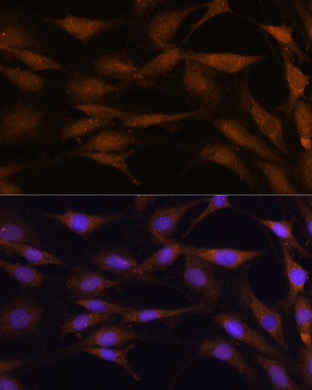 TFAP4 Antibody in Immunocytochemistry (ICC/IF)