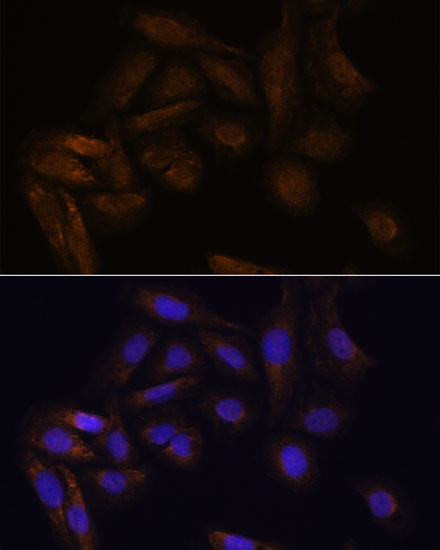 TFAP4 Antibody in Immunocytochemistry (ICC/IF)