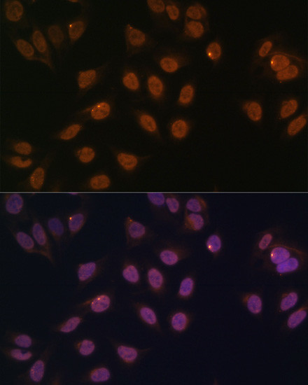 FOXG1 Antibody in Immunocytochemistry (ICC/IF)