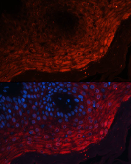 S100A8 Antibody in Immunohistochemistry (Paraffin) (IHC (P))