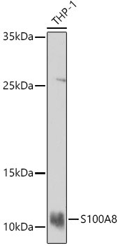 S100A8 Antibody in Western Blot (WB)