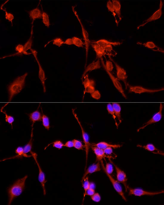 TSG101 Antibody in Immunocytochemistry (ICC/IF)