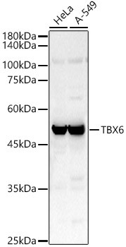 TBX6 Antibody in Western Blot (WB)