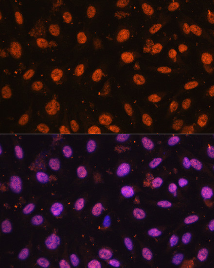 ZEB1 Antibody in Immunocytochemistry (ICC/IF)