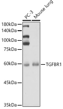 TGFBR1 Antibody in Western Blot (WB)