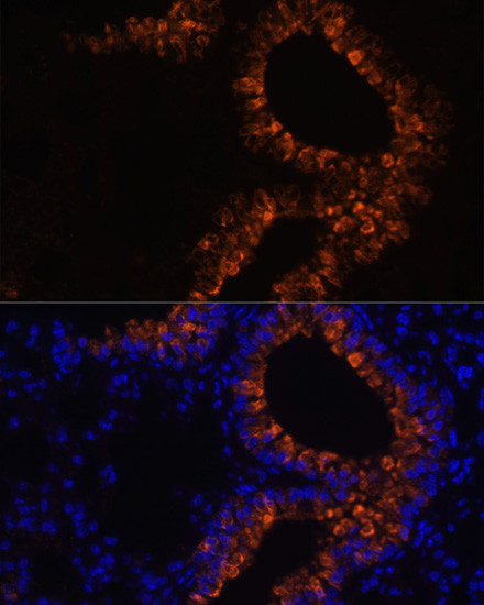 Uteroglobin Antibody in Immunocytochemistry (ICC/IF)