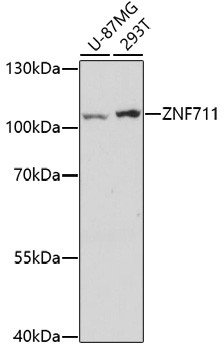 ZNF711 Antibody in Western Blot (WB)