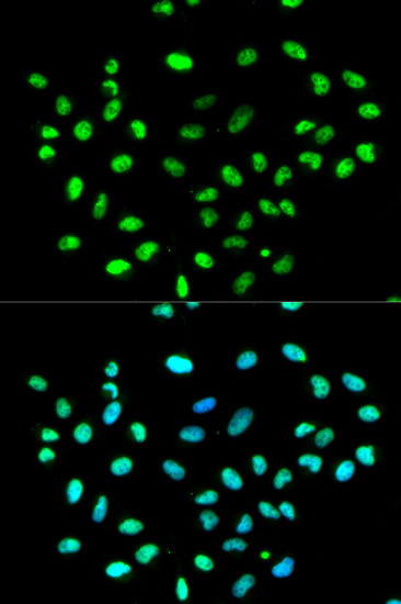 hnRNP K Antibody in Immunocytochemistry (ICC/IF)