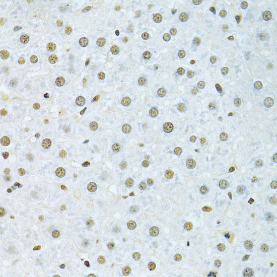 hnRNP K Antibody in Immunohistochemistry (Paraffin) (IHC (P))